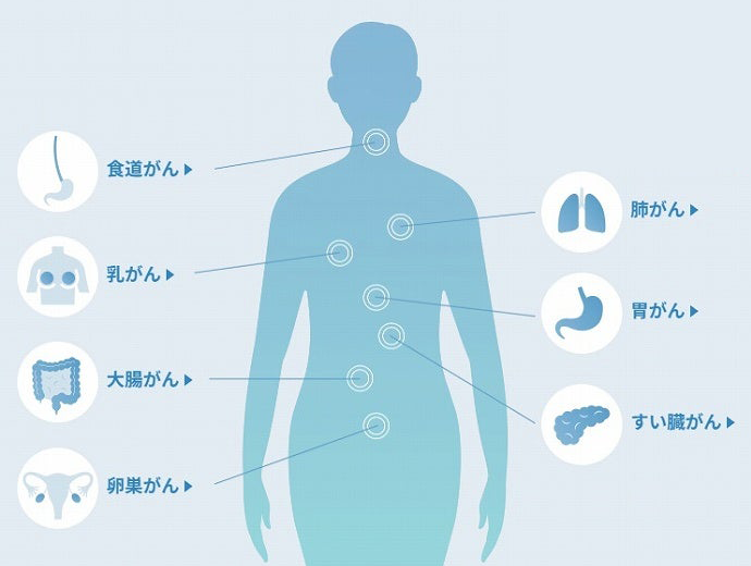 がん画像